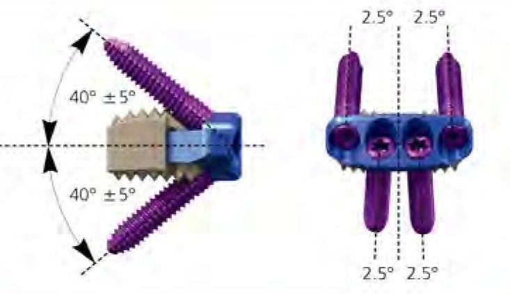 Шийний кейдж UMP, Тип ІІ 4*15.5*13мм